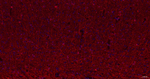 CNPase Antibody in Immunohistochemistry (Paraffin) (IHC (P))