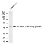 GC Recombinant Rabbit Monoclonal Antibody (12E5)