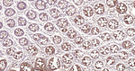 CEACAM5 Antibody in Immunohistochemistry (Paraffin) (IHC (P))