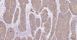 CEACAM5 Antibody in Immunohistochemistry (Paraffin) (IHC (P))