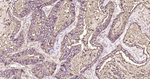 CEACAM5 Antibody in Immunohistochemistry (Paraffin) (IHC (P))