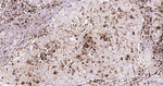 CEACAM5 Recombinant Rabbit Monoclonal Antibody (4F13)
