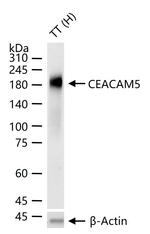CEACAM5 Antibody in Western Blot (WB)
