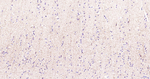 TAC1 Recombinant Rabbit Monoclonal Antibody (17A9)