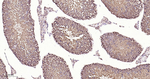 XBP1 Antibody in Immunohistochemistry (Paraffin) (IHC (P))
