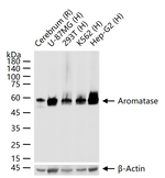 Aromatase Recombinant Rabbit Monoclonal Antibody (2F4)