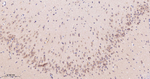 Cyclophilin A Antibody in Immunohistochemistry (Paraffin) (IHC (P))
