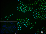 SMC3 Recombinant Rabbit Monoclonal Antibody (8E8)