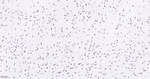 SMC3 Antibody in Immunohistochemistry (Paraffin) (IHC (P))