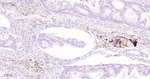 Cathepsin H/K/L/V Antibody in Immunohistochemistry (Paraffin) (IHC (P))