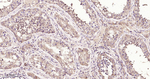 SDHA Antibody in Immunohistochemistry (Paraffin) (IHC (P))