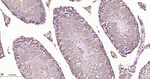 SDHA Antibody in Immunohistochemistry (Paraffin) (IHC (P))