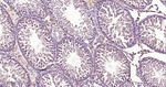 SDHA Antibody in Immunohistochemistry (Paraffin) (IHC (P))