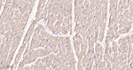 SDHA Antibody in Immunohistochemistry (Paraffin) (IHC (P))