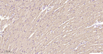 SDHA Antibody in Immunohistochemistry (Paraffin) (IHC (P))