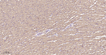 SDHA Antibody in Immunohistochemistry (Paraffin) (IHC (P))