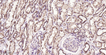 SDHA Antibody in Immunohistochemistry (Paraffin) (IHC (P))