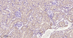 SDHA Antibody in Immunohistochemistry (Paraffin) (IHC (P))