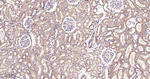 SDHA Antibody in Immunohistochemistry (Paraffin) (IHC (P))