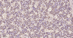 Growth Hormone Recombinant Rabbit Monoclonal Antibody (3B2)