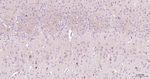 BNIP3 Antibody in Immunohistochemistry (Paraffin) (IHC (P))