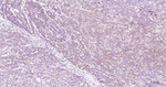 BNIP3 Recombinant Rabbit Monoclonal Antibody (10C11)