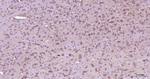BNIP3 Antibody in Immunohistochemistry (Paraffin) (IHC (P))