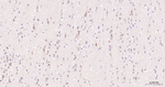 BNIP3 Antibody in Immunohistochemistry (Paraffin) (IHC (P))