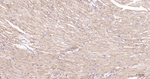BNIP3 Antibody in Immunohistochemistry (Paraffin) (IHC (P))