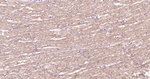 BNIP3 Antibody in Immunohistochemistry (Paraffin) (IHC (P))