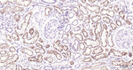 BNIP3 Antibody in Immunohistochemistry (Paraffin) (IHC (P))