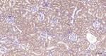 BNIP3 Antibody in Immunohistochemistry (Paraffin) (IHC (P))