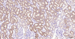 BNIP3 Antibody in Immunohistochemistry (Paraffin) (IHC (P))
