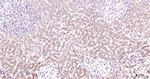 BNIP3 Antibody in Immunohistochemistry (Paraffin) (IHC (P))