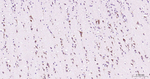Cathepsin B Antibody in Immunohistochemistry (Paraffin) (IHC (P))