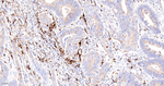 Cathepsin B Antibody in Immunohistochemistry (Paraffin) (IHC (P))