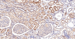 Cathepsin B Antibody in Immunohistochemistry (Paraffin) (IHC (P))