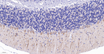DCLK1 Antibody in Immunohistochemistry (Paraffin) (IHC (P))