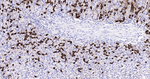 DCLK1 Antibody in Immunohistochemistry (Paraffin) (IHC (P))