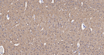 DCLK1 Antibody in Immunohistochemistry (Paraffin) (IHC (P))