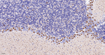 DCLK1 Antibody in Immunohistochemistry (Paraffin) (IHC (P))