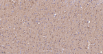 DCLK1 Antibody in Immunohistochemistry (Paraffin) (IHC (P))