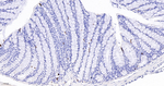DCLK1 Antibody in Immunohistochemistry (Paraffin) (IHC (P))