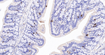 DCLK1 Antibody in Immunohistochemistry (Paraffin) (IHC (P))