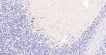 DCLK1 Antibody in Immunohistochemistry (Paraffin) (IHC (P))