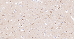 DCLK1 Antibody in Immunohistochemistry (Paraffin) (IHC (P))