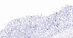 DCLK1 Antibody in Immunohistochemistry (Paraffin) (IHC (P))