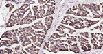 ATP5A1 Recombinant Rabbit Monoclonal Antibody (4E10)