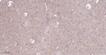 ATP5A1 Antibody in Immunohistochemistry (Paraffin) (IHC (P))
