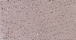 ATP5A1 Antibody in Immunohistochemistry (Paraffin) (IHC (P))